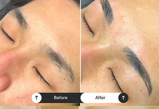 選ばれる理由03